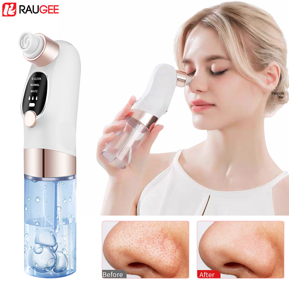 Nasal Aspirator - Removedor de cravo elétrico extrator de